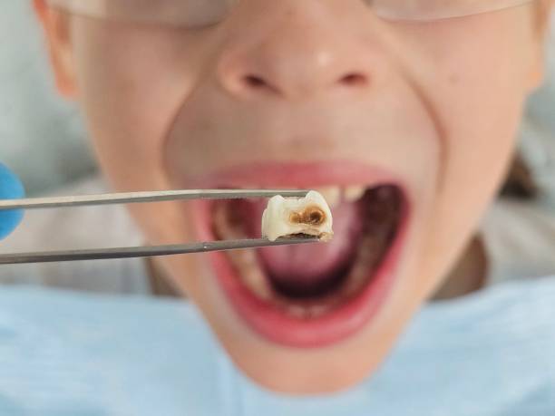 Best Emergency Treatment for Toothache in Tehachapi, CA